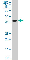 1 - TCEA3 Antibody (monoclonal) (M07) AT4176a