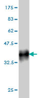 1 - TCFL5 Antibody (monoclonal) (M01) AT4193a