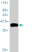 1 - TCL1B Antibody (monoclonal) (M01) AT4196a