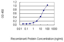 10 - TCOF1 Antibody (monoclonal) (M02) AT4197a
