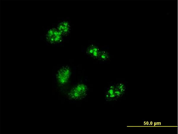 3 - TCOF1 Antibody (monoclonal) (M02) AT4197a