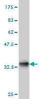 1 - TCOF1 Antibody (monoclonal) (M02) AT4197a