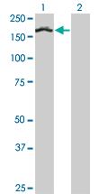 1 - TCOF1 Antibody (monoclonal) (M02) AT4197a