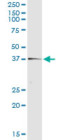 5 - TEX264 Antibody (monoclonal) (M01) AT4211a