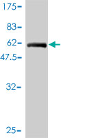 1 - TEX264 Antibody (monoclonal) (M01) AT4211a
