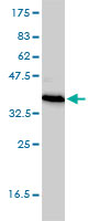 1 - TEX264 Antibody (monoclonal) (M01) AT4211a