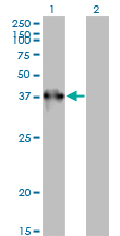 1 - TEX264 Antibody (monoclonal) (M01) AT4211a