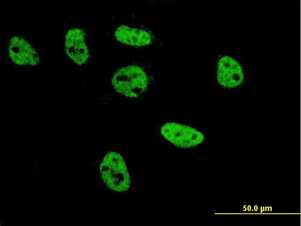 3 - TFAP2B Antibody (monoclonal) (M02) AT4212a