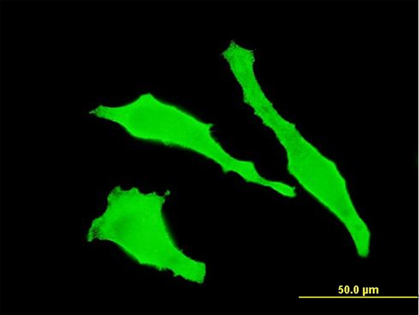 3 - TGOLN2 Antibody (monoclonal) (M02) AT4230a