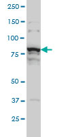 1 - THNSL1 Antibody (monoclonal) (M08) AT4233a