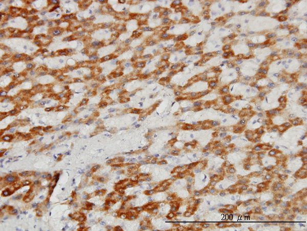 2 - TIMM8A Antibody (monoclonal) (M01) AT4239a