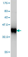 1 - TIMM8A Antibody (monoclonal) (M01) AT4239a