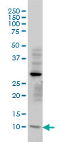 1 - TIMM8A Antibody (monoclonal) (M01) AT4239a
