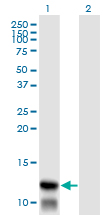 1 - TIMM8A Antibody (monoclonal) (M01) AT4239a