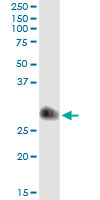 5 - TIMP1 Antibody (monoclonal) (M01) AT4241a