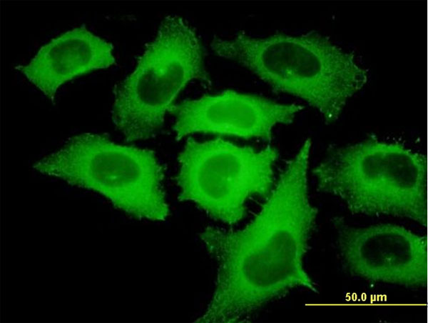 3 - TIPIN Antibody (monoclonal) (M01) AT4247a
