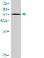 1 - TIPIN Antibody (monoclonal) (M01) AT4247a