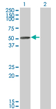 1 - TIPIN Antibody (monoclonal) (M01) AT4247a