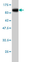 1 - TLR10 Antibody (monoclonal) (M01) AT4254a