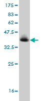 1 - TMEM1 Antibody (monoclonal) (M01) AT4263a
