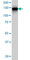 1 - TMEM1 Antibody (monoclonal) (M01) AT4263a