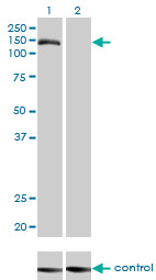 1 - TMEM1 Antibody (monoclonal) (M01) AT4263a