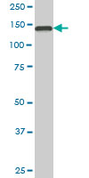1 - TMEM1 Antibody (monoclonal) (M02) AT4264a
