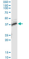 5 - TNFRSF10B Antibody (monoclonal) (M01) AT4271a