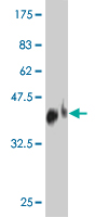 1 - TNFRSF19L Antibody (monoclonal) (M01) AT4278a