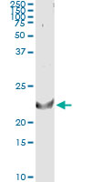 5 - TNFSF14 Antibody (monoclonal) (M01) AT4288a