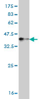 1 - TNNT3 Antibody (monoclonal) (M02) AT4293a