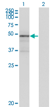 1 - TNXB Antibody (monoclonal) (M01) AT4296a