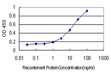 10 - TOP3B Antibody (monoclonal) (M01) AT4306a