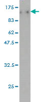 1 - TOP3B Antibody (monoclonal) (M01) AT4306a