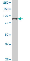 1 - TOP3B Antibody (monoclonal) (M01) AT4306a