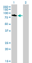 1 - TOP3B Antibody (monoclonal) (M01) AT4306a