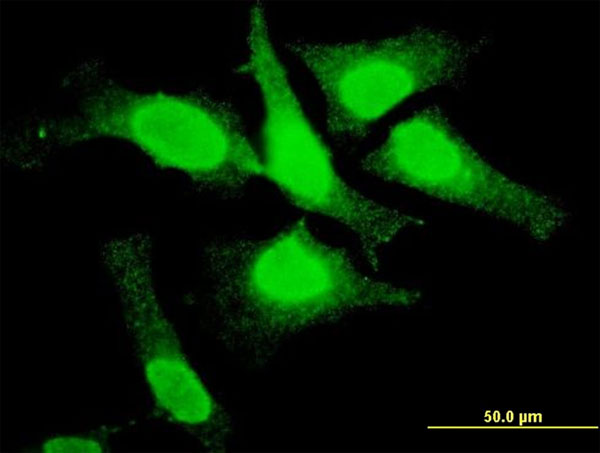3 - TOP3B Antibody (monoclonal) (M05) AT4307a