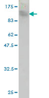1 - TOP3B Antibody (monoclonal) (M05) AT4307a