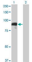 1 - TOP3B Antibody (monoclonal) (M05) AT4307a