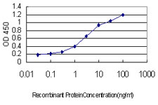 10 - TOPORS Antibody (monoclonal) (M01) AT4308a