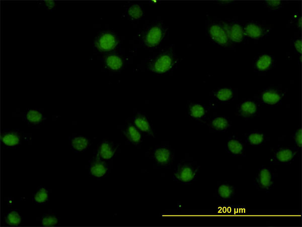 3 - TOPORS Antibody (monoclonal) (M01) AT4308a
