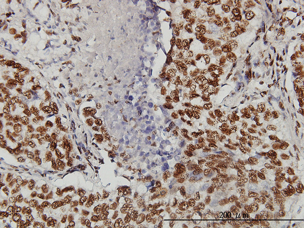 2 - TOPORS Antibody (monoclonal) (M01) AT4308a