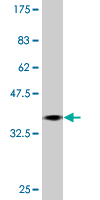 1 - TOPORS Antibody (monoclonal) (M01) AT4308a