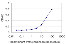 10 - TOPORS Antibody (monoclonal) (M02) AT4309a