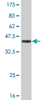 1 - TOPORS Antibody (monoclonal) (M02) AT4309a