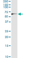 5 - TP53 Antibody (monoclonal) (M01) AT4310a