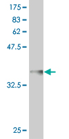 1 - TPRX1 Antibody (monoclonal) (M02) AT4325a