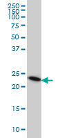 1 - TRAPPC4 Antibody (monoclonal) (M01) AT4334a