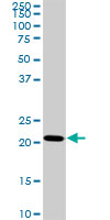 1 - TRAPPC4 Antibody (monoclonal) (M01) AT4334a
