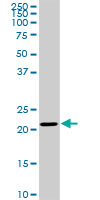 1 - TRAPPC4 Antibody (monoclonal) (M01) AT4334a